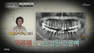 미리보기 이미지