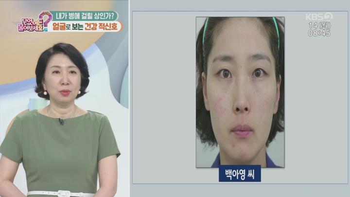 무엇이든 물어보세요.E3761.250714.1080p.H264-F1RST 비디오 썸네일 이미지
