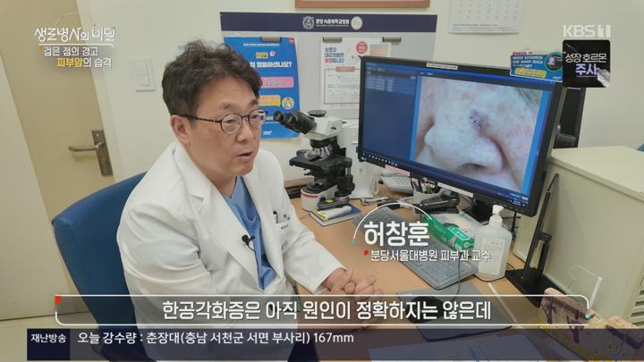 생로병사의 비밀.검은 점의 경고, 피부암의 습격.E959.250716.1080p.H264-F1RST 비디오 썸네일 이미지