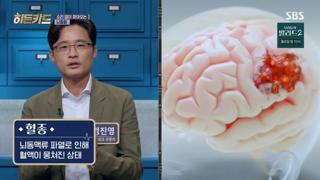 미리보기 이미지