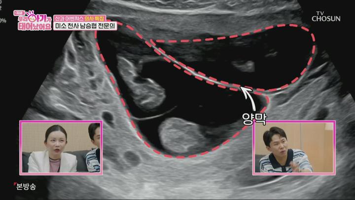 우리 아기가 태어났어요.E05.250613.1080p.H265-F1RST 비디오 썸네일 이미지