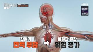 미리보기 이미지