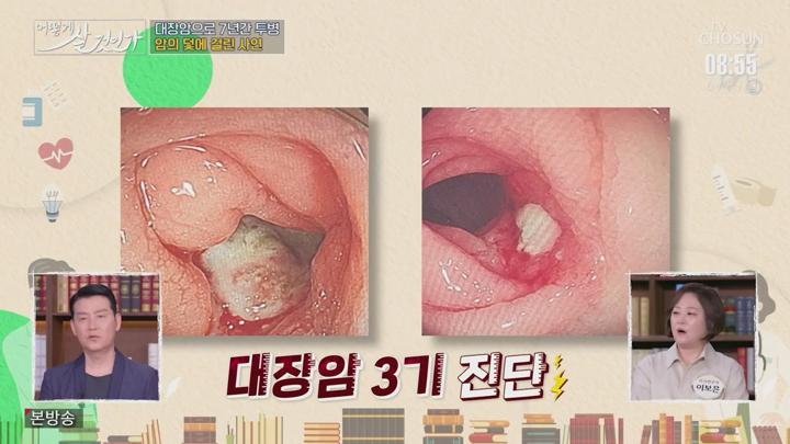 어떻게 살 것인가.E34(암을 이겨낼 방법).250608.720p.mp4 비디오 썸네일 이미지