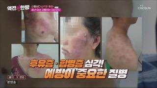 미리보기 이미지